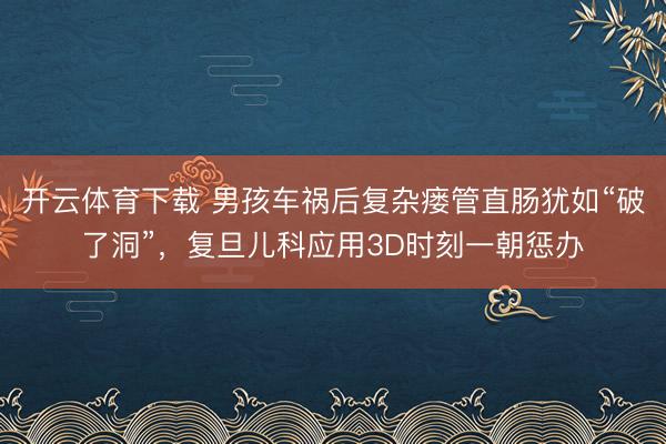 开云体育下载 男孩车祸后复杂瘘管直肠犹如“破了洞”，复旦儿科应用3D时刻一朝惩办